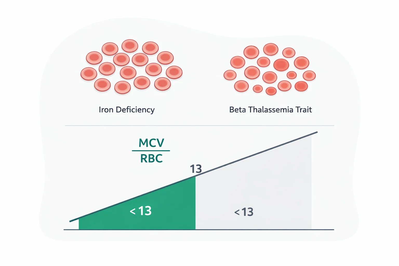 Medical illustration of microcytic red blood cells in iron deficiency versus beta thalassemia trait with the Mentzer index formula and its 13 cutoff line